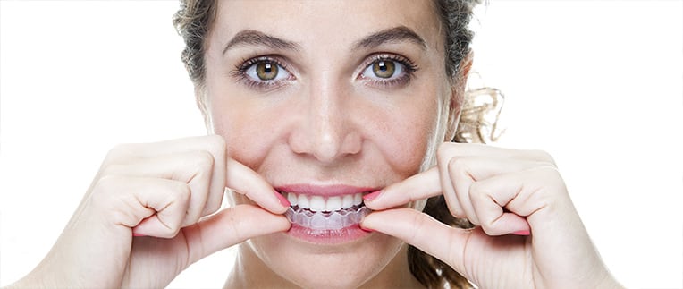 Invisalign in Red Deer  Invisalign Clear Aligners in Red Deer